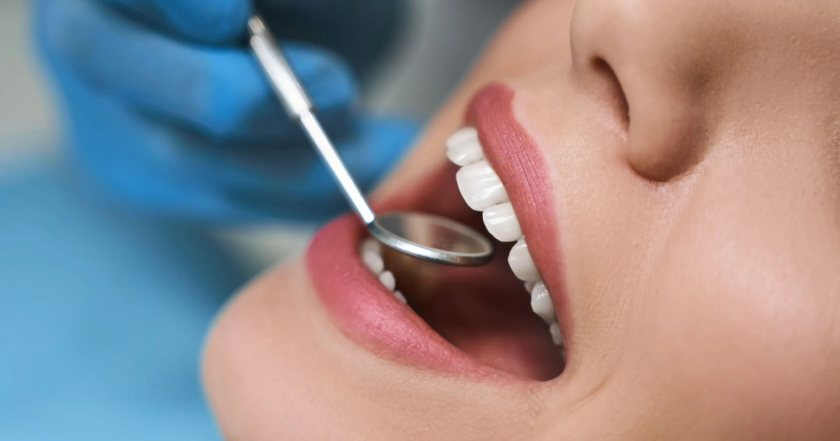 Higiene oral