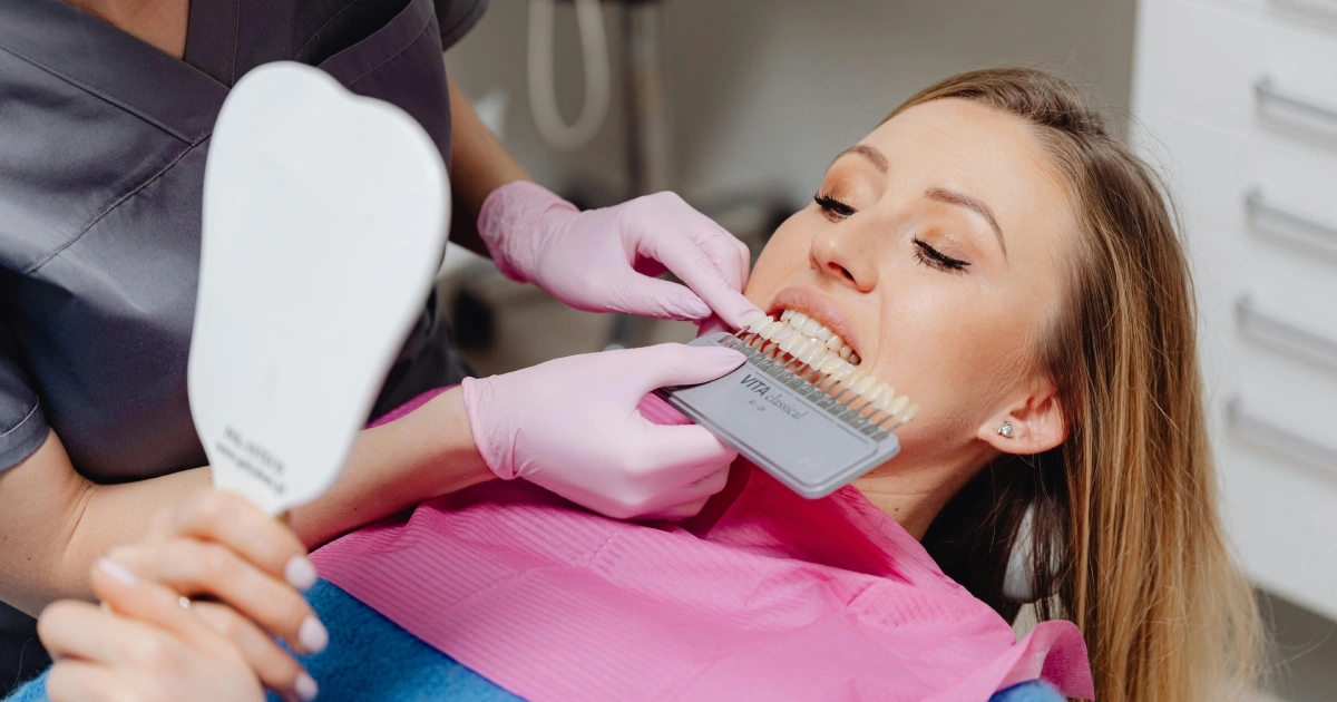 Facetas dentárias