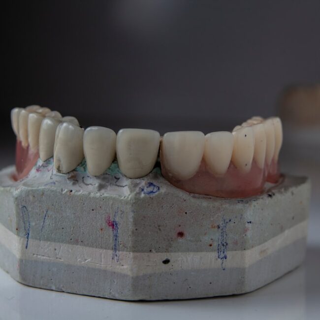 Photo Dental implant