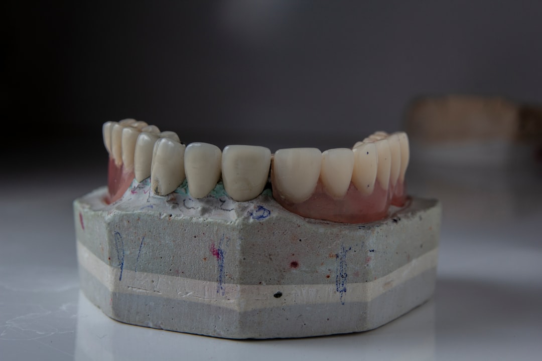 Photo Dental implant