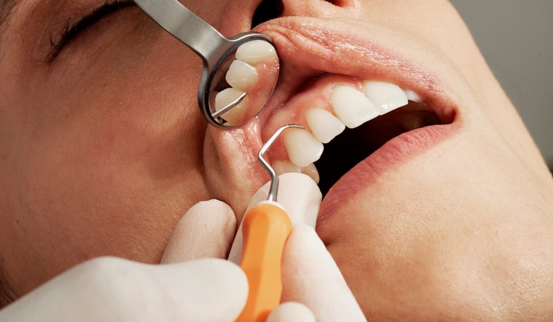 Photo Dental implant